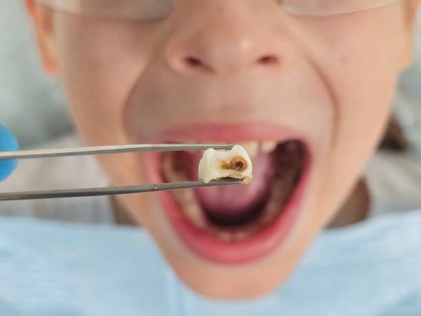 Best Tooth Infection Emergency Dentist  in Battle Mountain, NV